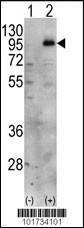 Anti-PIP5K1C Rabbit Polyclonal Antibody