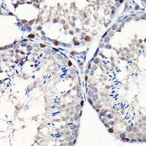 Anti-GTPBP4/NOG1 antibody