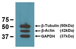 Three of Antibodies.com loading control mAbs reacting against 10 µg/lane of mouse brain tissue lysates. 50kDa band is Anti-ß-Tubulin (BT7R) at 1:2000 dilution (0.5 µg/ml); 42kDa band is Anti-ß-Actin (BA3R) at 1:1000 dilution (1 µg/ml); 37kDa band is Anti-GAPDH (GA1R) at 1:5000 dilution (0.2 µg/ml)