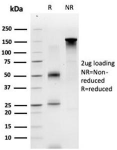 SDS-PAGE analysis of Anti-ECD Antibody [PCRP-ECD-1D10] under non-reduced and reduced conditions; showing intact IgG and intact heavy and light chains, respectively. SDS-PAGE analysis confirms the integrity and purity of the Antibody