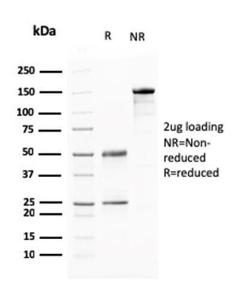 SDS-PAGE analysis of Anti-BARX1 Antibody [BARX1/2760] under non-reduced and reduced conditions; showing intact IgG and intact heavy and light chains, respectively. SDS-PAGE analysis confirms the integrity and purity of the antibody