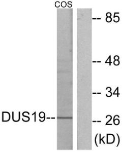 Western blot analysis of lysates from COS7 cells using Anti-DUSP19 Antibody. The right hand lane represents a negative control, where the antibody is blocked by the immunising peptide