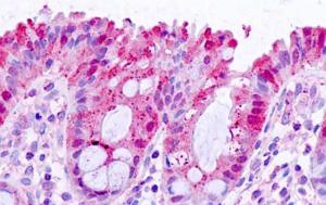 Anti-LGALS3 Antibody (A83625) (10 µg/ml) staining of paraffin embedded Human Colon. Steamed antigen retrieval with citrate buffer pH 6, AP-staining