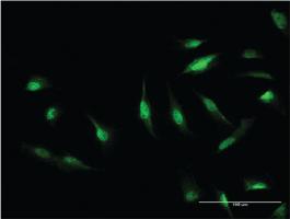 Anti-CAND1 Mouse Monoclonal Antibody [clone: 1G5]