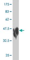 Anti-CDH2 Mouse Monoclonal Antibody [clone: 5C8]