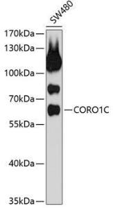 Anti-Coronin-1C Antibody (A9504)