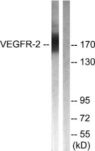 Western blot analysis of lysates from HepG2 cells, treated with Na3VO4 0.3nM 40' using Anti-VEGFR2 Antibody. The right hand lane represents a negative control, where the Antibody is blocked by the immunising peptide