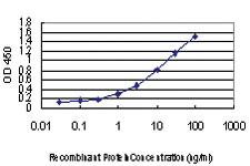 Anti-GLTSCR2 Mouse Monoclonal Antibody [clone: 5A8]