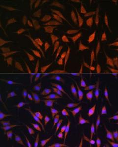 Immunofluorescence analysis of L929 cells using Anti-RALGDS Antibody (A93309) at a dilution of 1:100. DAPI was used to stain the cell nuclei (blue)