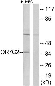 Western blot analysis of lysates from HUVEC cells using Anti-OR7C2 Antibody The right hand lane represents a negative control, where the antibody is blocked by the immunising peptide