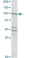 Anti-CBL Rabbit Polyclonal Antibody