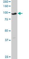 Anti-KAT2A Mouse Monoclonal Antibody [clone: 4F9]