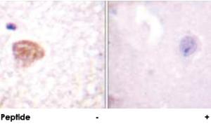 Anti-DDX3X Rabbit Polyclonal Antibody