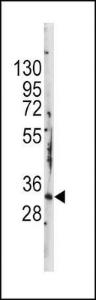 Anti-STAP1 Rabbit Polyclonal Antibody (FITC (Fluorescein))