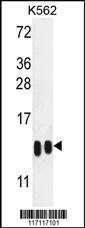 Anti-H4-K20 Rabbit Polyclonal Antibody (AP (Alkaline Phosphatase))