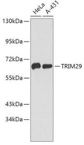 Anti-TRIM29 antibody