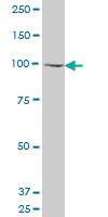 Anti-KAT2A Mouse Monoclonal Antibody [clone: 4F9]