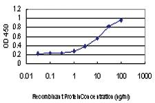 Anti-RAB6A Mouse Monoclonal Antibody [clone: 3G3]