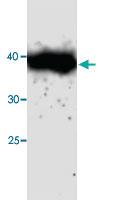 Anti-CTSH Mouse Monoclonal Antibody [clone: 69s45]