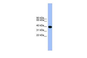 Anti-SERPINA1 Rabbit Polyclonal Antibody