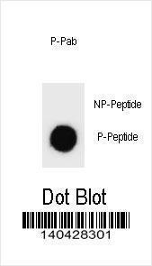 Anti-AMOT Rabbit Polyclonal Antibody (AP (Alkaline Phosphatase))