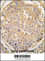 Anti-DKK4 Rabbit Polyclonal Antibody (AP (Alkaline Phosphatase))