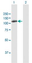 Anti-CBL Rabbit Polyclonal Antibody