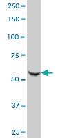 Anti-KAT2A Mouse Monoclonal Antibody [clone: 3F8]