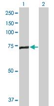 Anti-EFHC1 Rabbit Polyclonal Antibody