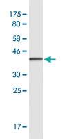 Anti-CUX2 Mouse Monoclonal Antibody [clone: 2H8]