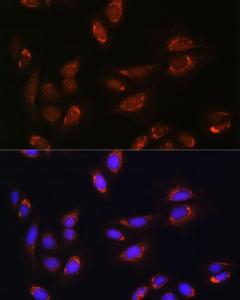 Immunofluorescence analysis of U-2 OS cells using Anti-RALGDS Antibody (A93309) at a dilution of 1:100. DAPI was used to stain the cell nuclei (blue)