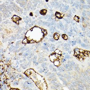 Anti-CD133 Rabbit Polyclonal Antibody