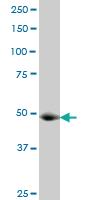 Anti-KAT2A Mouse Monoclonal Antibody [clone: 3F8]