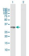 Anti-ZNF397 Rabbit Polyclonal Antibody