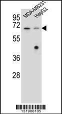 Anti-GLMN Rabbit Polyclonal Antibody (Biotin)