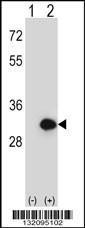 Anti-BPGM Rabbit Polyclonal Antibody (AP (Alkaline Phosphatase))