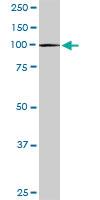 Anti-CBL Rabbit Polyclonal Antibody