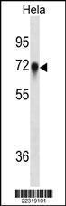 Anti-CD55 Mouse Monoclonal Antibody [clone: 561CT4.2.3]