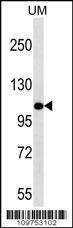 Anti-MYO3B Rabbit Polyclonal Antibody (Biotin)