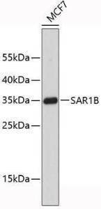 Western blot analysis of extracts of MCF-7 cells, using Anti-SAR1B Antibody (A9547) The secondary antibody was Goat Anti-Rabbit IgG H&L Antibody (HRP) at 1:10,000 dilution Lysates/proteins were present at 25 µg per lane