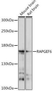 Western blot analysis of extracts of various cell lines, using Anti-RAPGEF6 Antibody (A93310) at 1:1,000 dilution. The secondary antibody was Goat Anti-Rabbit IgG H&L Antibody (HRP) at 1:10,000 dilution.