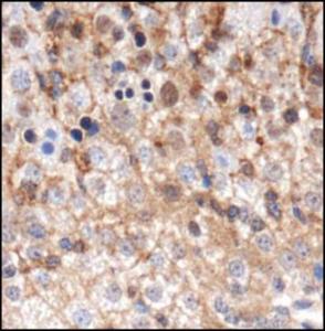 Anti-GABARAP Rabbit Polyclonal Antibody