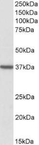 Anti-TOMM40 Antibody (A83628) (2 µg/ml) staining of Human Frontal Cortex lysate (35 µg protein in RIPA buffer). Primary incubation was 1 hour. Detected by chemiluminescence