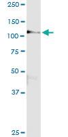 Anti-CBL Rabbit Polyclonal Antibody