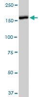 Anti-CACNA2D2 Mouse Monoclonal Antibody [clone: 4E3]