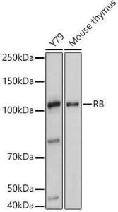 Western blot analysis of extracts of various cell lines, using Anti-Rb Antibody (A93312) at 1:1000 dilution. The secondary Antibody was Goat Anti-Rabbit IgG H&L Antibody (HRP) at 1:10000 dilution. Lysates/proteins were present at 25 µg per lane