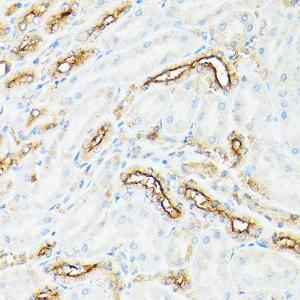 Anti-CD133 Rabbit Polyclonal Antibody