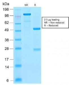 SDS-PAGE analysis of Anti-p21 Antibody [CIP1/2275R] under non-reduced and reduced conditions; showing intact IgG and intact heavy and light chains, respectively. SDS-PAGE analysis confirms the integrity and purity of the antibody