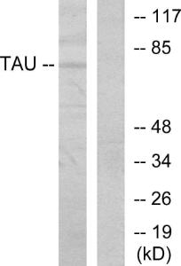 Western blot analysis of lysates from MDA-MB-435 cells using Anti-Tau Antibody. The right hand lane represents a negative control, where the antibody is blocked by the immunising peptide.