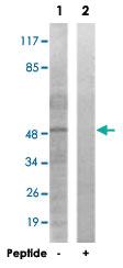 Anti-EPB49 Rabbit Polyclonal Antibody